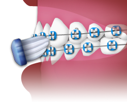 Brushing - Step 3