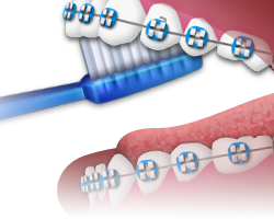 Brushing - Step 5