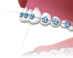 Flossing - Step 3