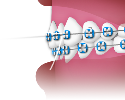 Flossing - Step 4