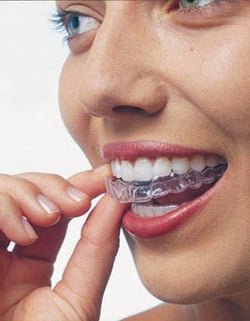 invisalign